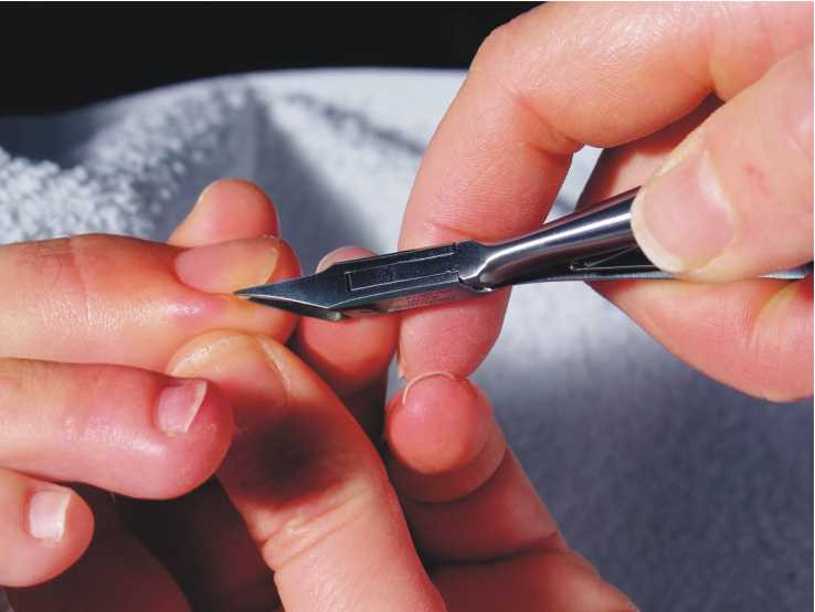 Ногтями можно резать. Подстриженные ногти. Вырезание вросшего ногтя. Неправильно подстриженные ногти.